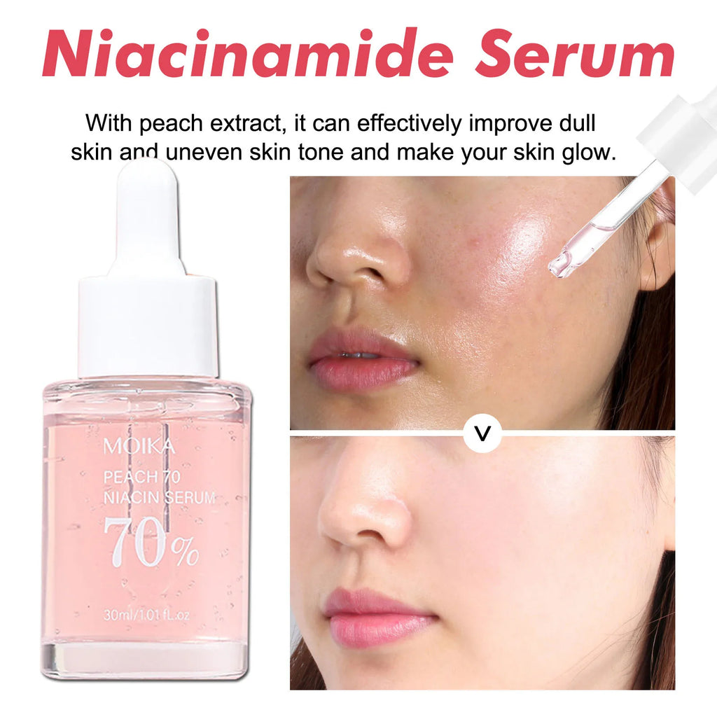 Suero de Niacinamida 10% + Arbutina 2%: Corrector de Manchas y Poros